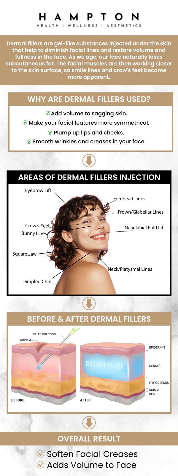 Dermal fillers improve facial features for a more youthful look by efficiently restoring lost volume and smoothing out fine wrinkles. They are a well-liked option for non-surgical face rejuvenation since they offer quick, natural-looking results with little downtime. At Hampton Health Wellness Aesthetics, Duane Hampton, NP, and Jeannie Ocasio-Hampton, NP, offer dermal fillers as a popular and effective means of facial rejuvenation. We are conveniently located at 2543 Route 52 Hopewell Junction, NY 12533. For more information, contact us or book an appointment online. Dermal fillers improve facial features for a more youthful look by efficiently restoring lost volume and smoothing out fine wrinkles. They are a well-liked option for non-surgical face rejuvenation since they offer quick, natural-looking results with little downtime. At Hampton Health Wellness Aesthetics, Duane Hampton, NP, and Jeannie Ocasio-Hampton, NP, offer dermal fillers as a popular and effective means of facial rejuvenation. We are conveniently located at 2543 Route 52 Hopewell Junction, NY 12533. For more information, contact us or book an appointment online.