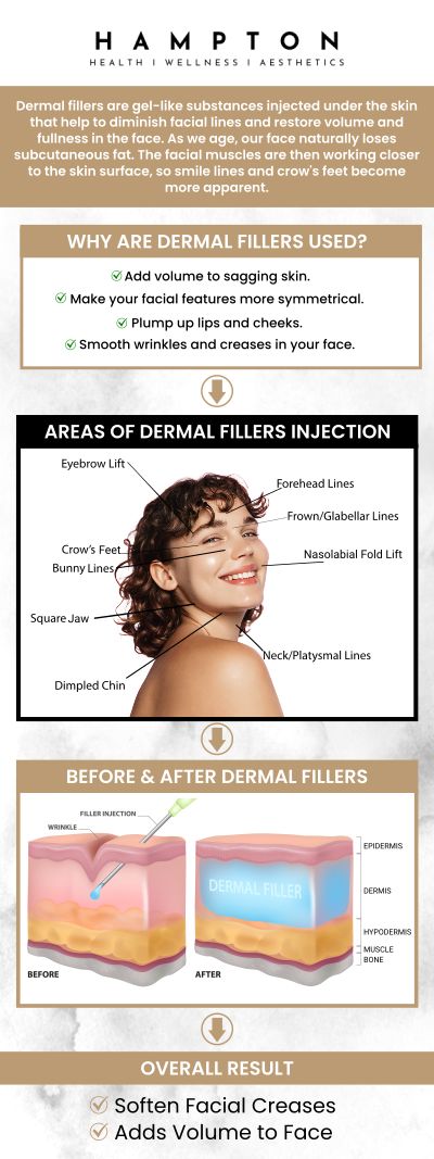 Dermal fillers improve facial features for a more youthful look by efficiently restoring lost volume and smoothing out fine wrinkles. They are a well-liked option for non-surgical face rejuvenation since they offer quick, natural-looking results with little downtime. At Hampton Health Wellness Aesthetics, Duane Hampton, NP, and Jeannie Ocasio-Hampton, NP, offer dermal fillers as a popular and effective means of facial rejuvenation. We are conveniently located at 2543 Route 52 Hopewell Junction, NY 12533. For more information, contact us or book an appointment online. Dermal fillers improve facial features for a more youthful look by efficiently restoring lost volume and smoothing out fine wrinkles. They are a well-liked option for non-surgical face rejuvenation since they offer quick, natural-looking results with little downtime. At Hampton Health Wellness Aesthetics, Duane Hampton, NP, and Jeannie Ocasio-Hampton, NP, offer dermal fillers as a popular and effective means of facial rejuvenation. We are conveniently located at 2543 Route 52 Hopewell Junction, NY 12533. For more information, contact us or book an appointment online.