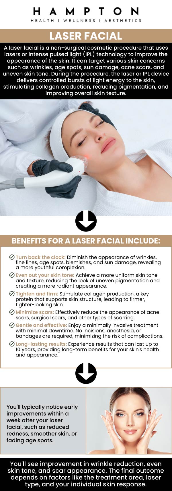 At Hampton Health Wellness Aesthetics, Duane Hampton, NP, and Jeannie Ocasio-Hampton, NP, offer Laser treatments that provide significant benefits for facial rejuvenation by effectively addressing many common skin concerns. Our team prioritizes personalized care, thorough evaluations, and state-of-the-art laser technologies, helping each client achieve a refreshed, radiant appearance safely and comfortably. For more information, contact us or book an appointment online. We are conveniently located at 2543 Route 52 Hopewell Junction, New York 12533. At Hampton Health Wellness Aesthetics, Duane Hampton, NP, and Jeannie Ocasio-Hampton, NP, offer Laser treatments that provide significant benefits for facial rejuvenation by effectively addressing many common skin concerns. Our team prioritizes personalized care, thorough evaluations, and state-of-the-art laser technologies, helping each client achieve a refreshed, radiant appearance safely and comfortably. For more information, contact us or book an appointment online. We are conveniently located at 2543 Route 52 Hopewell Junction, New York 12533.