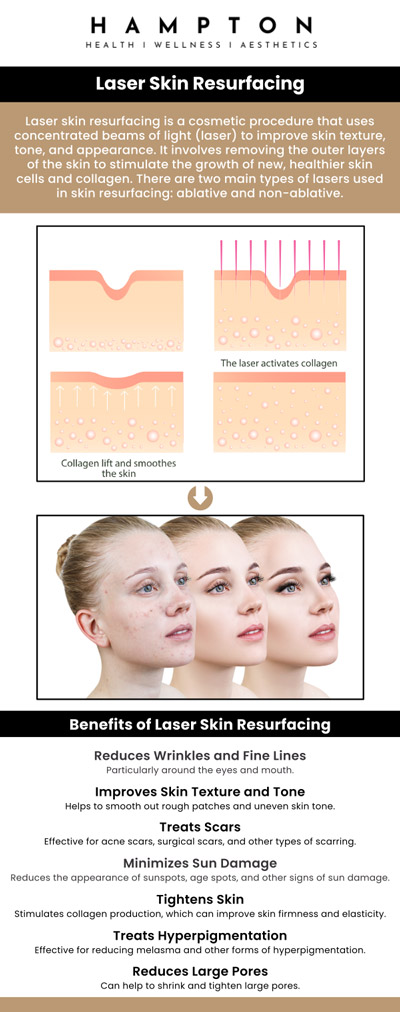 Laser skin resurfacing is used to smooth out the texture of the skin and lessen the visibility of wrinkles, scars, and pigmentation. Duane Hampton, NP, and Jeannie Ocasio-Hampton, NP, offer laser skin resurfacing, which targets the skin's surface, and encourages the creation of collagen, giving the complexion a smoother, more youthful appearance. We are conveniently located at 2543 Route 52 Hopewell Junction, NY 12533. For more information, contact us or book an appointment online. Laser skin resurfacing is used to smooth out the texture of the skin and lessen the visibility of wrinkles, scars, and pigmentation. Duane Hampton, NP, and Jeannie Ocasio-Hampton, NP, offer laser skin resurfacing, which targets the skin's surface, and encourages the creation of collagen, giving the complexion a smoother, more youthful appearance. We are conveniently located at 2543 Route 52 Hopewell Junction, NY 12533. For more information, contact us or book an appointment online.