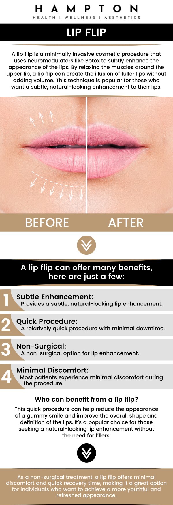 Common questions asked by clients: What is a lip flip, and how does it work? How soon will I see results from a lip flip? Who is a good candidate for a lip flip treatment? For more information, contact us or schedule an appointment online. We are conveniently located at 2543 Route 52 Hopewell Junction, NY 12533. We serve patients from Hopewell Junction NY, Stormville NY, Beekman NY, Wappingers Falls NY, Kent NY, Pawling NY, and surrounding areas. Common questions asked by clients: What is a lip flip, and how does it work? How soon will I see results from a lip flip? Who is a good candidate for a lip flip treatment? For more information, contact us or schedule an appointment online. We are conveniently located at 2543 Route 52 Hopewell Junction, NY 12533. We serve patients from Hopewell Junction NY, Stormville NY, Beekman NY, Wappingers Falls NY, Kent NY, Pawling NY, and surrounding areas.