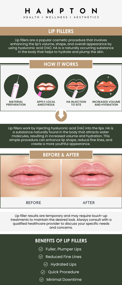 Lip fillers are non-surgical injectables, typically made with hyaluronic acid, used to add volume and enhance the shape of the lips. A topical numbing agent is applied for comfort before the quick procedure. Post-treatment effects may include immediate plumpness, temporary swelling, or mild bruising, generally resolving within a week. Consult with Duane Hampton, NP, and Jeannie Ocasio-Hampton, NP, for this highly customizable and reversible treatment, which is favored for restoring lost volume and smoothing fine lines with minimal downtime. For more information, contact us or book an appointment online. We are conveniently located at 2543 Route 52 Hopewell Junction, NY 12533. Lip fillers are non-surgical injectables, typically made with hyaluronic acid, used to add volume and enhance the shape of the lips. A topical numbing agent is applied for comfort before the quick procedure. Post-treatment effects may include immediate plumpness, temporary swelling, or mild bruising, generally resolving within a week. Consult with Duane Hampton, NP, and Jeannie Ocasio-Hampton, NP, for this highly customizable and reversible treatment, which is favored for restoring lost volume and smoothing fine lines with minimal downtime. For more information, contact us or book an appointment online. We are conveniently located at 2543 Route 52 Hopewell Junction, NY 12533.
