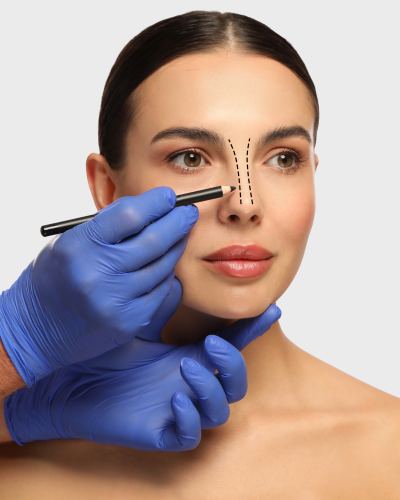 Botox for Bunny Lines in Hopewell Junction, NY