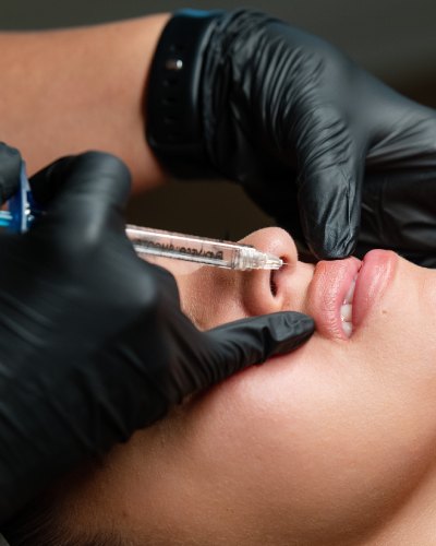 Fillers Near Me in Hopewell Junction, NY Fillers Near Me in Hopewell Junction, NY